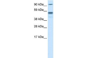 WB Suggested Anti-SEPT4 Titration:  0. (Septin 4 抗体  (N-Term))