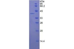 SDS-PAGE of Protein Standard from the Kit (Highly purified E. (KRT16 ELISA 试剂盒)