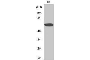 Western Blotting (WB) image for anti-SUMO1 Activating Enzyme Subunit 2 (UBA2) (C-Term) antibody (ABIN3187391) (UBA2 抗体  (C-Term))