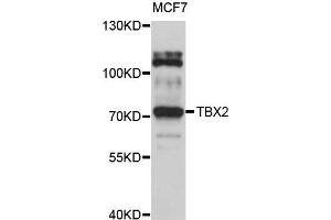 Western blot analysis of extract of MCF7 cells, using TBX2 antibody. (TBX2 抗体)