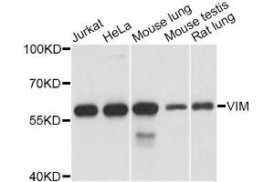 Western blot analysis of extracts of various cell lines, using VIM antibody. (Vimentin 抗体  (AA 1-101))