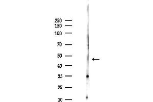 anti-Chromosome 6 Open Reading Frame 134 (C6orf134) (Internal Region) antibody