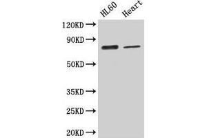 Western Blot Positive WB detected in: HL60 whole cell lysate, Mouse heart tissue All lanes: CAST antibody at 2. (Calpastatin 抗体  (AA 1-667))
