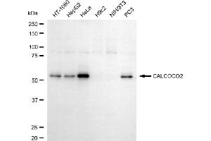 Western blotting analysis using anti-CALCOCO2 antibody (ABIN7797826).