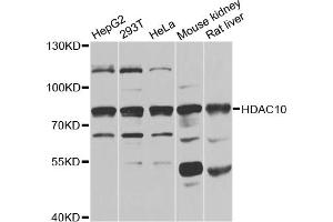 Western blot analysis of extracts of various cell lines, using HDAC10 antibody (ABIN5975007) at 1/1000 dilution. (HDAC10 抗体)