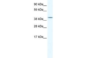 WB Suggested Anti-ISL2 Antibody Titration:  5. (ISL2 抗体  (C-Term))