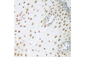 Immunohistochemistry of paraffin-embedded human esophagus using HDAC1 antibody (ABIN5970068) at dilution of 1/100 (40x lens). (HDAC1 抗体  (N-Term))