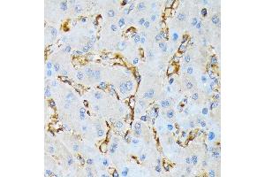 Immunohistochemistry of paraffin-embedded human liver using IQG Rabbit mAb (ABIN7268019) at dilution of 1:100 (40x lens). (IQGAP1 抗体)