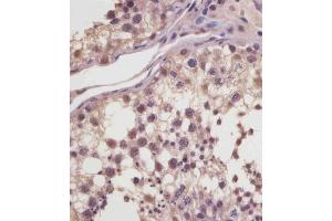 (ABIN6244040 and ABIN6578881) staining MGEA5 in human testis tissue sections by Immunohistochemistry (IHC-P - paraformaldehyde-fixed, paraffin-embedded sections). (MGEA5 抗体  (AA 236-269))