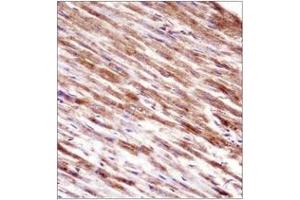 Immunohistochemistry analysis in formalin fixed and paraffin embedded human heart tissue reacted with HSPBP1 Antibody (N-term) followed which was peroxidase conjugated to the secondary antibody and  followed by DAB staining. (HSPBP1 抗体  (N-Term))