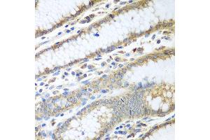 Immunohistochemistry of paraffin-embedded human stomach using PDIA3 antibody at dilution of 1:100 (40x lens). (PDIA3 抗体)