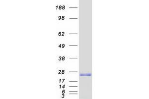 Western Blotting (WB) image for Chromosome 13 Open Reading Frame 15 (C13orf15) protein (Myc-DYKDDDDK Tag) (ABIN2712359)