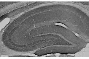 Adult rat hippocampus immunohistochemistry. (ANK2 抗体  (AA 203-496))