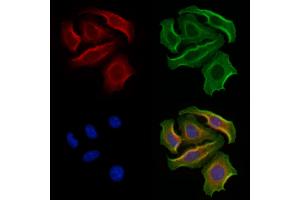 ABIN7094373 and ABIN7098420 staining Hela cells by IF/ICC.
