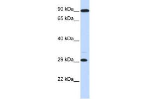 WB Suggested Anti-HOXB8 Antibody Titration:  0. (HOXB8 抗体  (Middle Region))