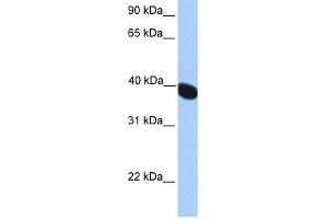 WB Suggested Anti-NEURL2 Antibody Titration: 0. (NEURL2 抗体  (N-Term))