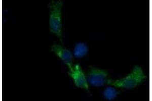 Image no. 3 for anti-Retinoic Acid Receptor Responder (Tazarotene Induced) 1 (RARRES1) antibody (ABIN1500601) (RARRES1 抗体)