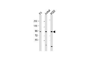 Western Blot at 1:2000 dilution Lane 1: F9 whole cell lysate Lane 2: Jurkat whole cell lysate Lane 3: K562 whole cell lysate Lysates/proteins at 20 ug per lane. (NUP93 抗体  (AA 20-54))