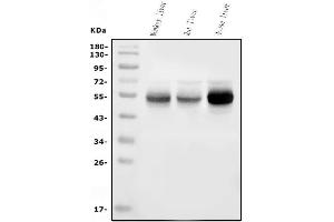 Western blot analysis of Cytochrome p450 2C19/CYP2C19 using anti-Cytochrome p450 2C19/CYP2C19 antibody (ABIN7603006).