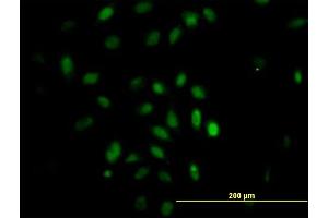 Immunofluorescence of monoclonal antibody to TRIM49 on HeLa cell. (TRIM49 抗体  (AA 251-340))