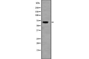 Western blot analysis of SLC5A5 expression in HEK293 cells (SLC5A5 抗体  (Internal Region))