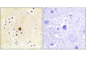Immunohistochemistry analysis of paraffin-embedded human brain tissue, using RyR2 (Ab-2808) Antibody. (RYR2 抗体  (AA 2774-2823))