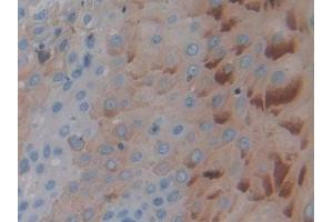 Immunohistochemistry (IHC) image for anti-Protein tyrosine Phosphatase, Receptor Type, H (PTPRH) (AA 844-1096) antibody (ABIN7442888)