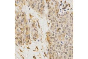 Immunohistochemistry (Paraffin-embedded Sections) (IHC (p)) image for anti-Golgi-Associated, gamma Adaptin Ear Containing, ARF Binding Protein 2 (GGA2) (AA 1-300) antibody (ABIN3021665)
