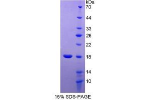 Image no. 1 for Regulator of Chromosome Condensation (RCC1) and BTB (POZ) Domain Containing Protein 2 (RCBTB2) (AA 394-519) protein (His tag) (ABIN6237648) (RCBTB2 Protein (AA 394-519) (His tag))