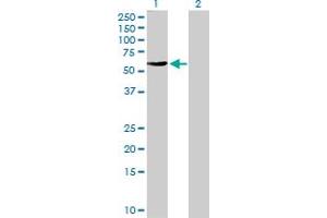 Western Blot analysis of FBXO4 expression in transfected 293T cell line by FBXO4 MaxPab polyclonal antibody. (FBXO4 抗体  (AA 1-387))