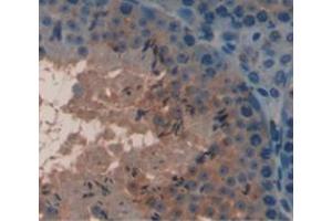 IHC-P analysis of Mouse Tissue, with DAB staining. (COMP 抗体  (AA 317-455))