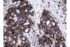 Image no. 2 for anti-Galactosidase, beta 1 (GLB1) antibody (ABIN1498467) (GLB1 抗体)