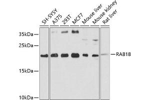 Western blot analysis of extracts of various cell lines, using R antibody (ABIN3016760, ABIN3016761, ABIN3016762 and ABIN6219834) at 1:1000 dilution. (RAB18 抗体  (AA 1-206))
