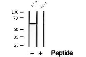 Western blot analysis of extracts of PC-3 cells, using DPP4 antibody.