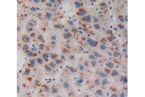 IHC-P analysis of Human Tissue, with DAB staining. (Endonuclease G 抗体  (AA 16-290))