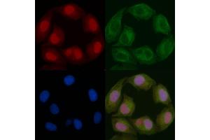 Nucleophosmin Mouse Monoclonal Antibody staining Hela cells by IF/ICC. (NPM1 抗体  (N-Term))