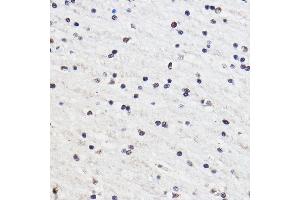 Immunohistochemistry of paraffin-embedded Rat brain using GTF3C3 Rabbit pAb (ABIN7267374) at dilution of 1:100 (40x lens). (GTF3C3 抗体)