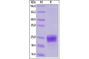 Human Flt-3 Ligand, His Tag on  under reducing (R) condition. (FLT3LG Protein (AA 27-185) (His tag))