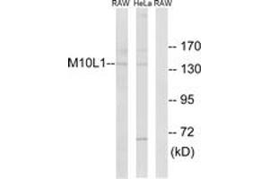 Western blot analysis of extracts from HeLa/RAW264. (MOV10L1 抗体  (AA 318-367))