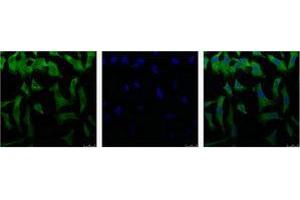 Immunofluorescence (IF) analysis of HeLa with antibody (Left) and DAPI (Right) diluted at 1:100. (EIF4A1 抗体)