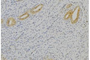ABIN6276804 at 1/100 staining Human uterus tissue by IHC-P. (TAC1 抗体  (N-Term))