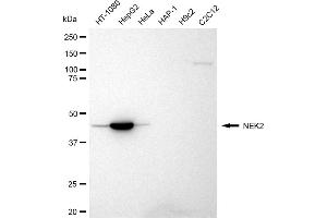 Western blotting analysis using NEK2 antibody (ABIN7799602). (Recombinant NEK2 抗体)
