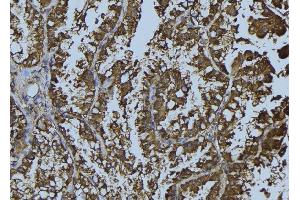 ABIN6268886 at 1/100 staining Mouse testis tissue by IHC-P. (Connexin 43/GJA1 抗体  (C-Term))