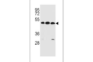 KREMEN2 Antibody (Center) (ABIN656978 and ABIN2846161) western blot analysis in ZR-75-1,K562,NCI- cell line lysates (35 μg/lane). (KREMEN2 抗体  (AA 248-276))