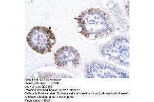 Human Intestine (GTF2B 抗体  (N-Term))