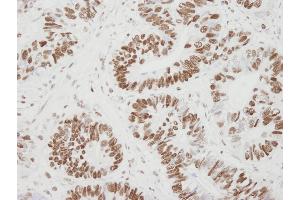 Immunohistochemistry (IHC) image for anti-Minichromosome Maintenance Complex Component 6 (MCM6) (C-Term) antibody (ABIN7448657)