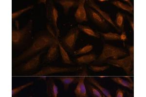 Immunofluorescence analysis of U-2 OS cells using UFC1 Polyclonal Antibody at dilution of 1:100 (40x lens). (UFC1 抗体)