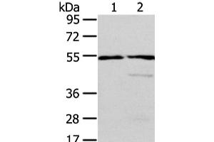 Western Blot analysis of Human normal liver and fetal liver tissue using ALDH3A2 Polyclonal Antibody at dilution of 1/250 (ALDH3A2 抗体)