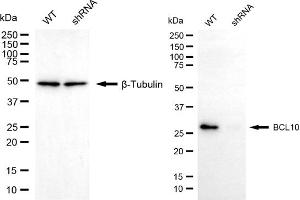 Western blotting analysis using BCL10 antibody (ABIN7797715). (BCL10 抗体)