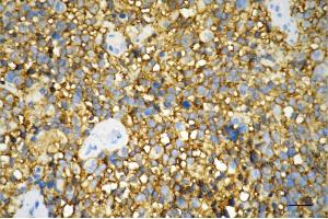 anti-Growth Associated Protein 43 (GAP43) antibody